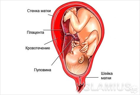 Месячные во время беременности