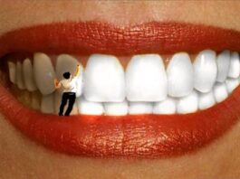 Отбеливание зубов: в каких случаях лучше не проводить