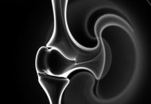 МРТ коленного сустава: что важно знать, чтобы понять результаты и не бояться исследования МРТ коленного сустава: что важно знать, чтобы понять результаты и не бояться исследования