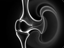 МРТ коленного сустава: что важно знать, чтобы понять результаты и не бояться исследования